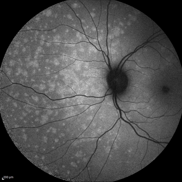 retinografia-e-autofluorescenza-da-sostituire-1.jpg